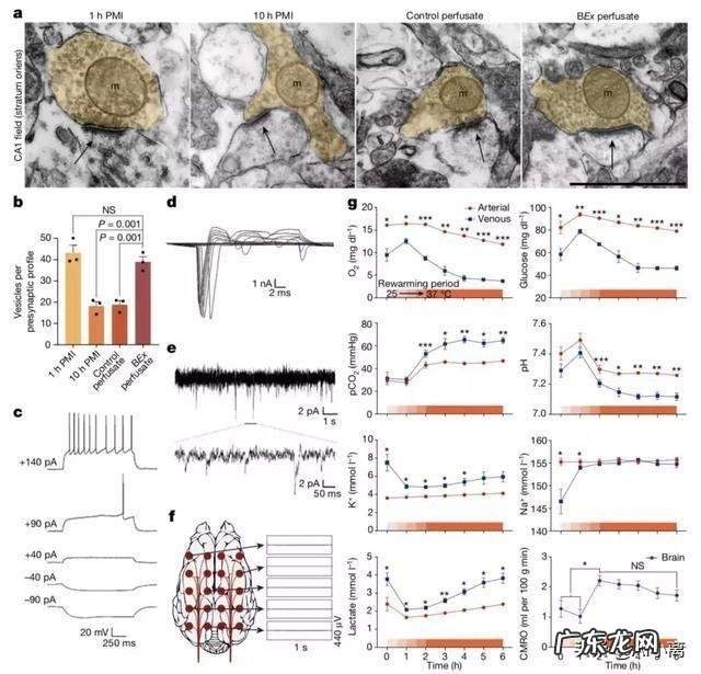 科学家已成功复活了死亡猪脑,是不是将来人类有可能长生不老?
