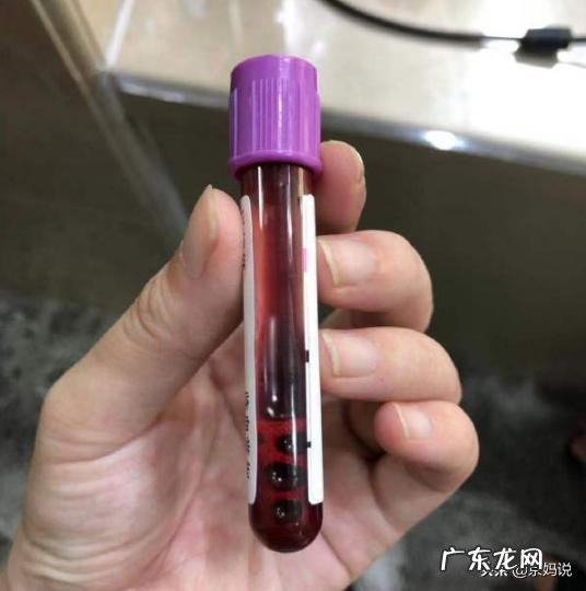 孕妇产检哪些是必须检查的项目?