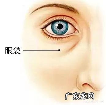 吸脂去眼袋多久才能恢复?