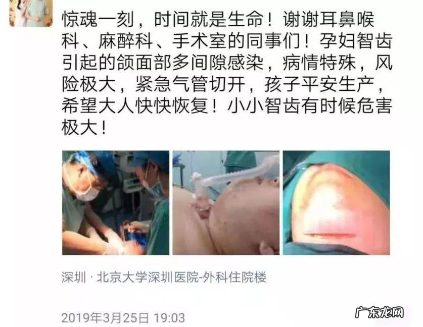 拔智齿风水 拔智齿会破坏风水吗