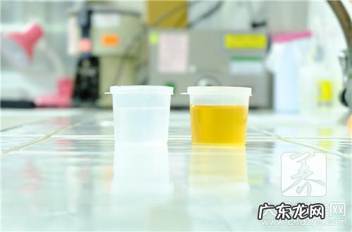 尿道损伤怎么查严重程度 尿道损伤怎样处理