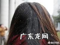 头皮屑怎么去除?