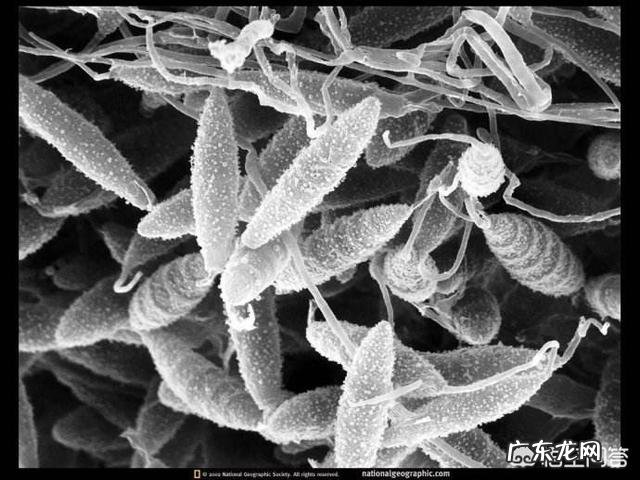 头皮屑怎么去除?