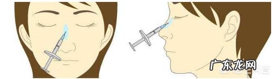 玻尿酸隆鼻可以维持多长时间?