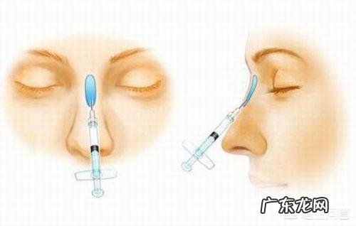 玻尿酸隆鼻可以维持多长时间?