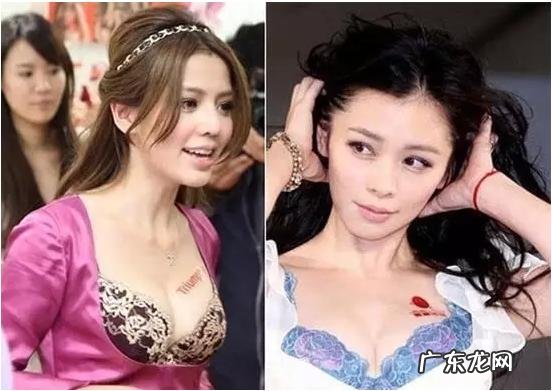 娱乐圈的“整容狂魔”有哪些?