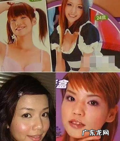 娱乐圈的“整容狂魔”有哪些?