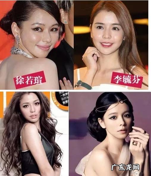 娱乐圈的“整容狂魔”有哪些?