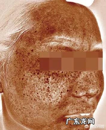 皮肤黄气很明显,美白精华效果很有限,有什么祛黄气的好办法?