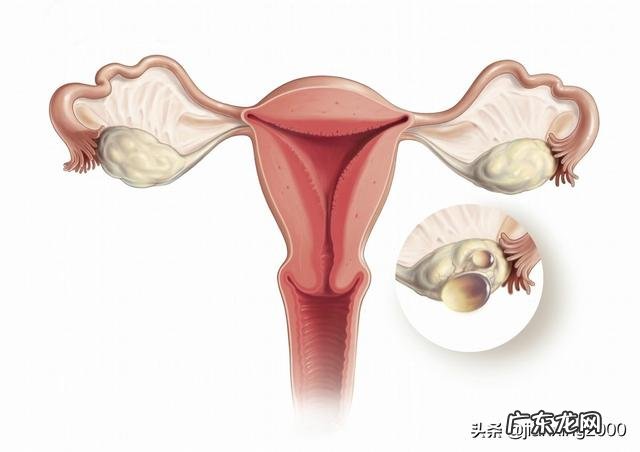 未婚女性会得妇科病吗?