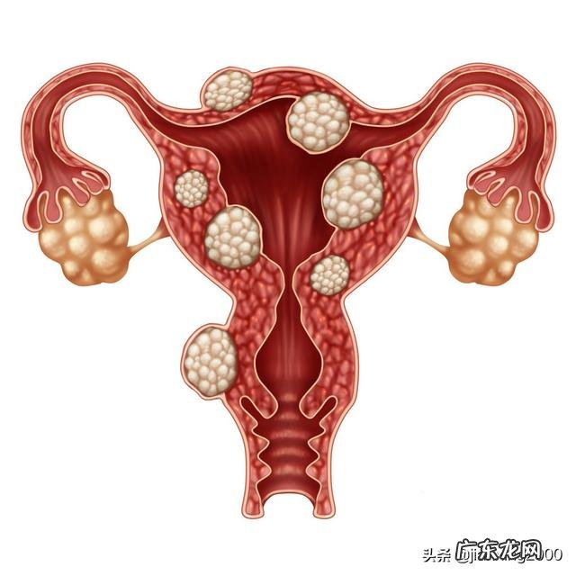 未婚女性会得妇科病吗?