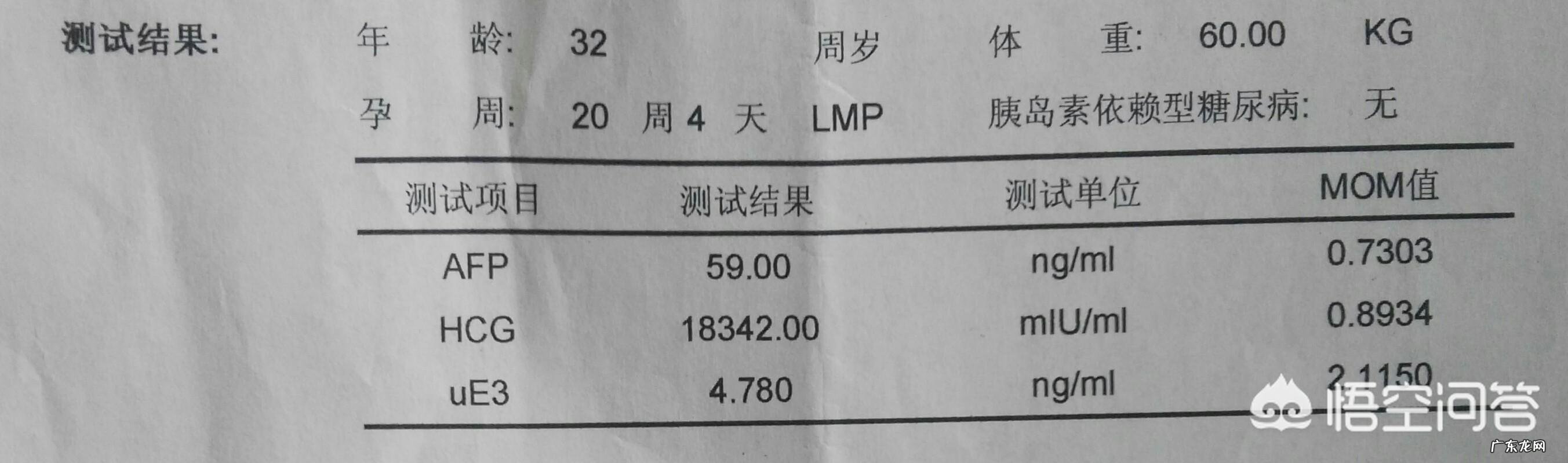 唐筛都做哪些检查什么?怎样才是正常的?