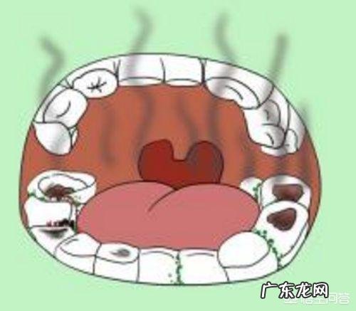 怎样可以防止口臭?