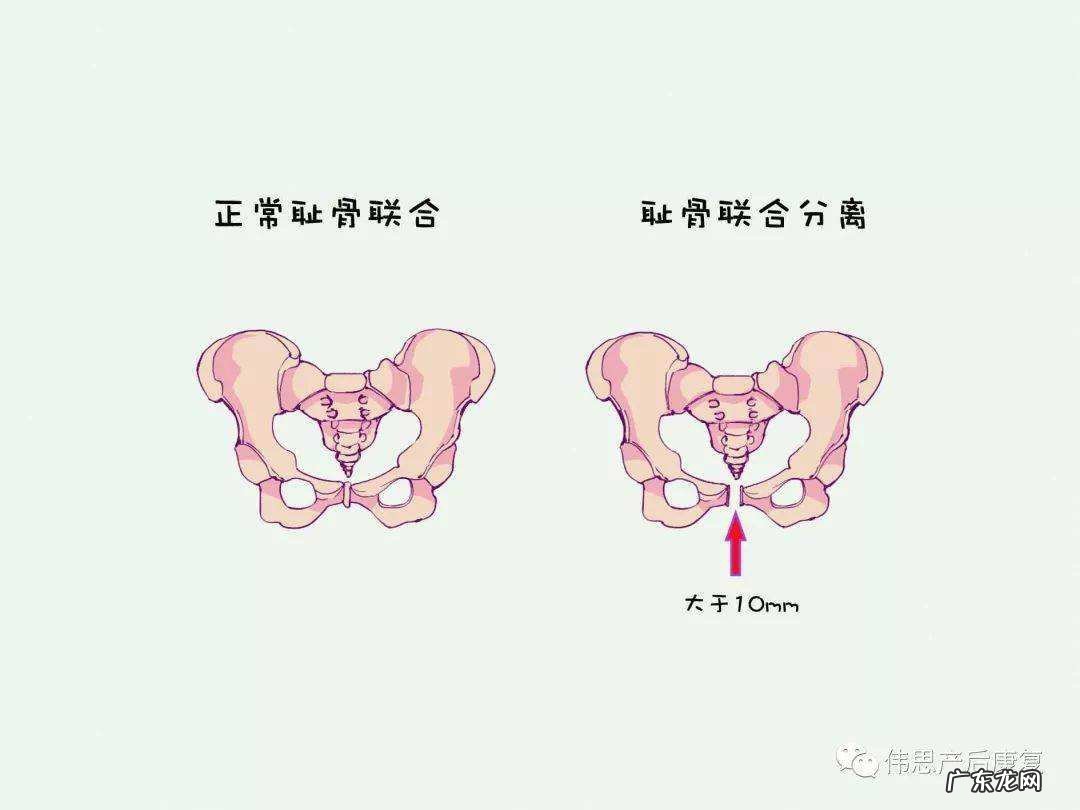 耻骨在哪个位置