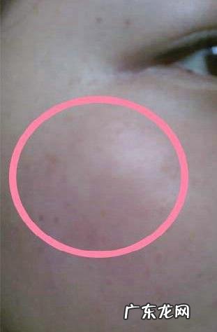 一到冬天,皮肤干燥得不能出门,应该怎么办?