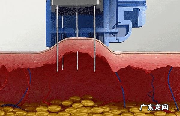 一到冬天,皮肤干燥得不能出门,应该怎么办?