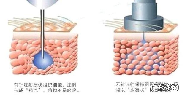 一到冬天,皮肤干燥得不能出门,应该怎么办?