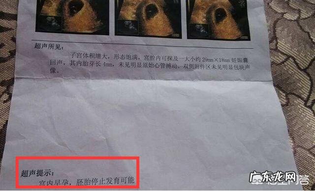 怀孕两个多月，胎儿为何会胎死腹中？