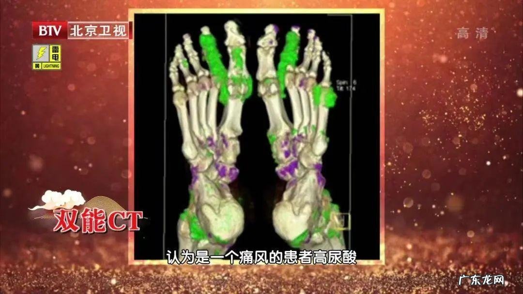 吃豆腐的好处和坏处 吃豆腐的好处?