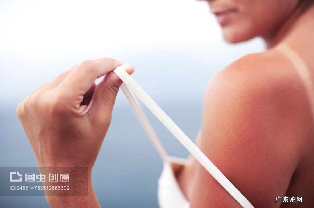 皮肤被晒伤了怎么处理