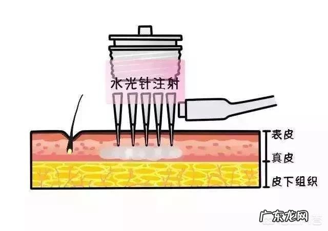 玻尿酸有什么用处?