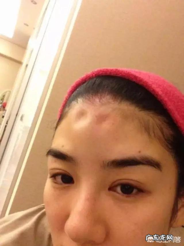 玻尿酸有什么用处?