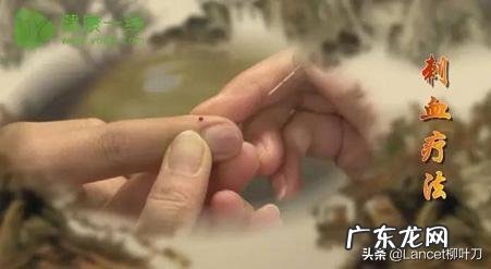 放血疗法你听说过吗?可以治疗高血压吗?