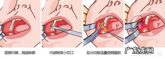 胖脸的女生如何变V脸?