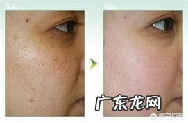 皮肤粗糙暗黄怎么办?