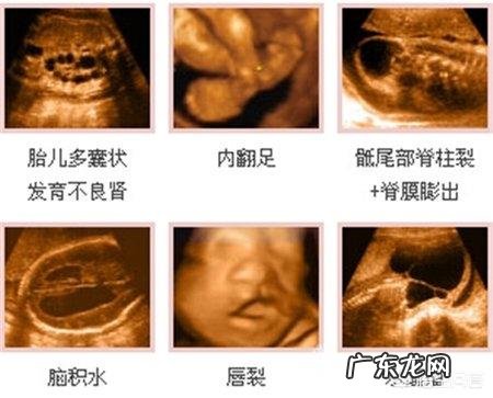 怀孕多少天做孕检?需要注意些什么?