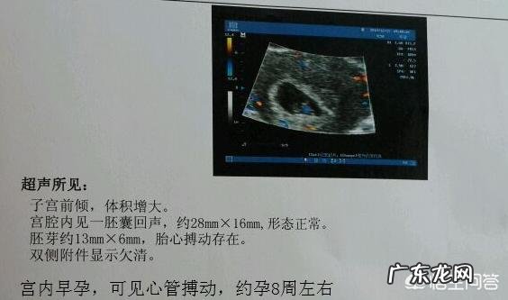 怀孕多少天做孕检?需要注意些什么?