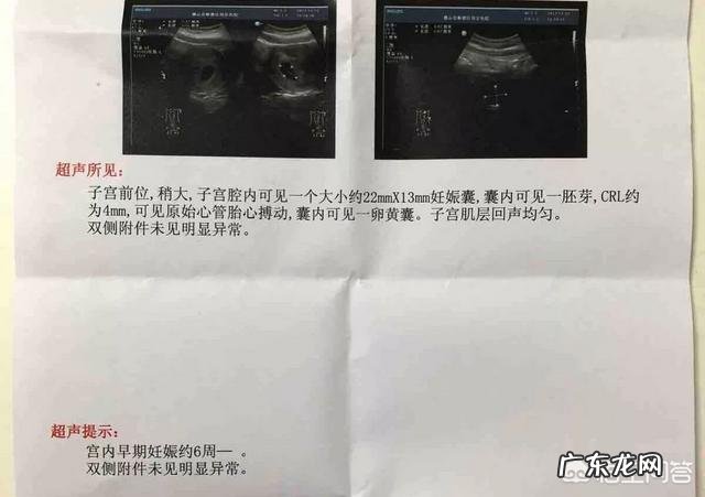 怀孕多少天做孕检?需要注意些什么?