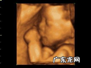 怎么预约四维彩超?第几周检查最好?原因是什么?