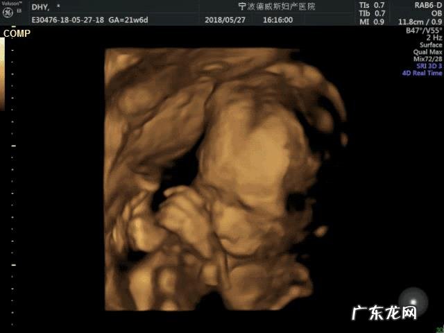 孕中期有哪些注意事项?