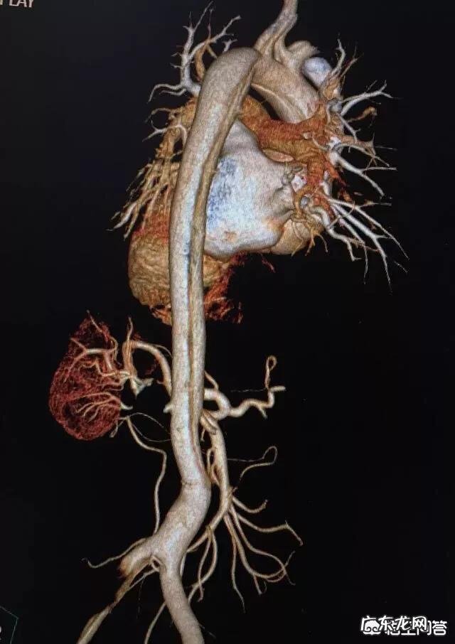 后背疼得厉害有可能是哪些原因导致的?该怎么办?