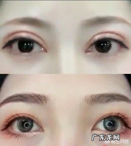 为什么双眼皮修复要等到半年以上？