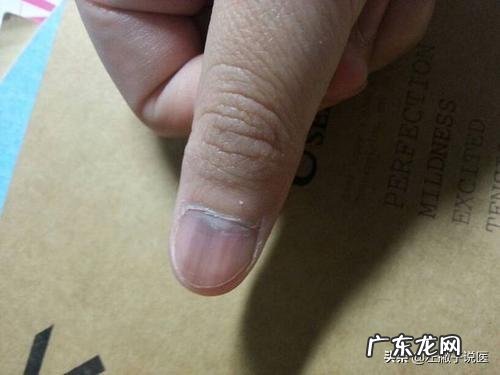 生活中有哪些养肝护肝的方法?