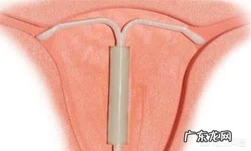 怀二胎还需要做产检吗？能少做几次检查吗？