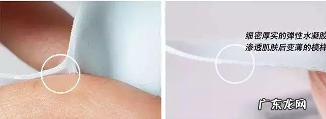 如何去除抬头纹 怎样去除抬头纹和法令纹