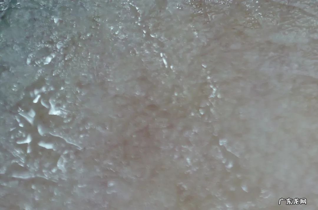 如何去除抬头纹 怎样去除抬头纹和法令纹