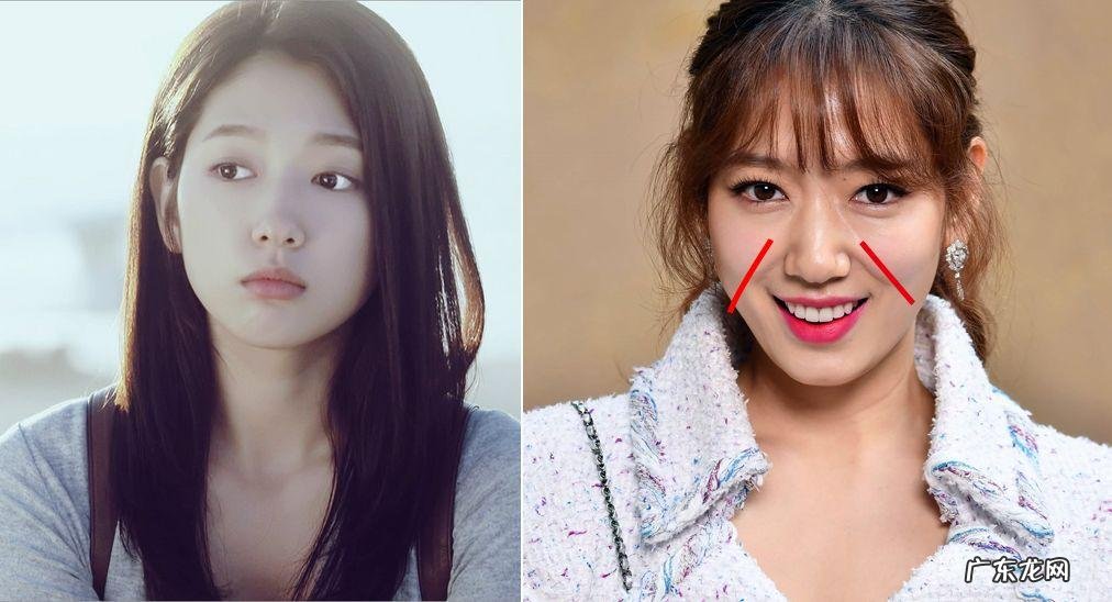 如何去除抬头纹 怎样去除抬头纹和法令纹