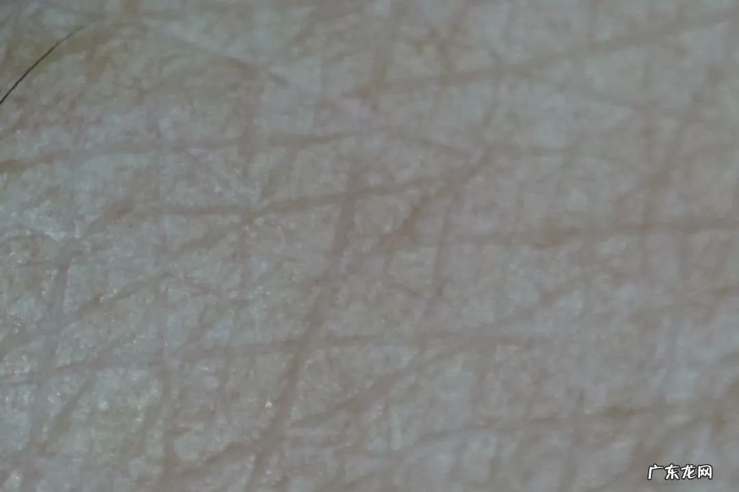 如何去除抬头纹 怎样去除抬头纹和法令纹