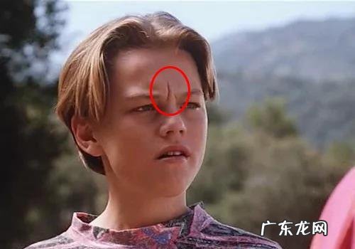 如何去除抬头纹 怎样去除抬头纹和法令纹