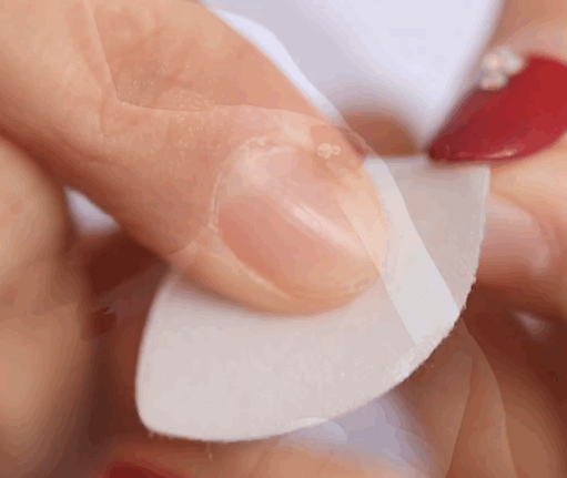 如何去除抬头纹 怎样去除抬头纹和法令纹