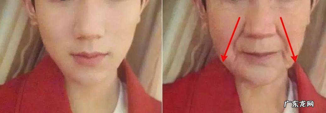 如何去除抬头纹 怎样去除抬头纹和法令纹