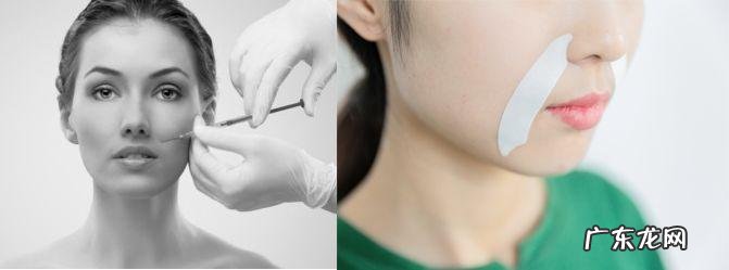 如何去除抬头纹 怎样去除抬头纹和法令纹