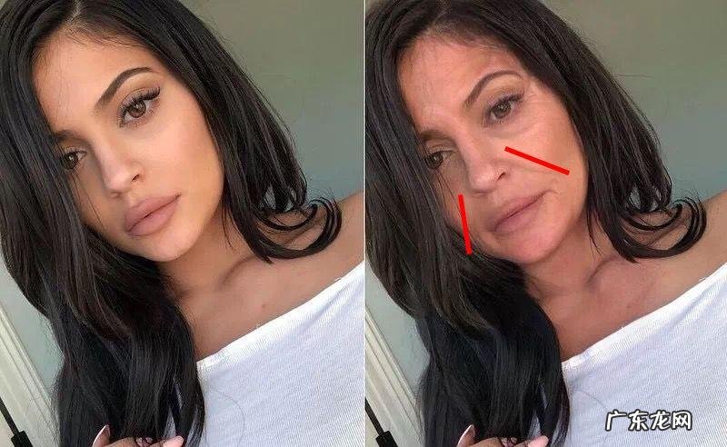 如何去除抬头纹 怎样去除抬头纹和法令纹