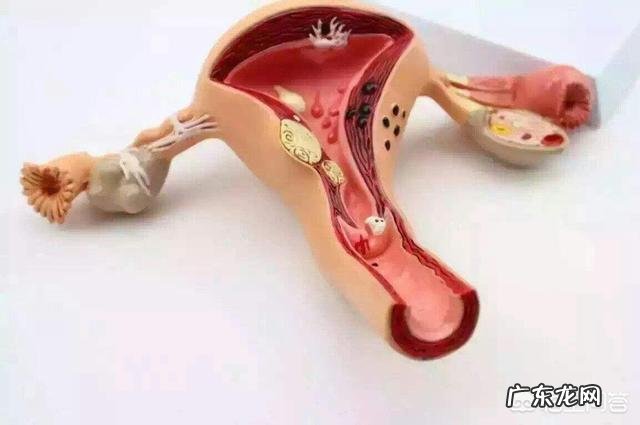 子宫肌瘤严重吗？