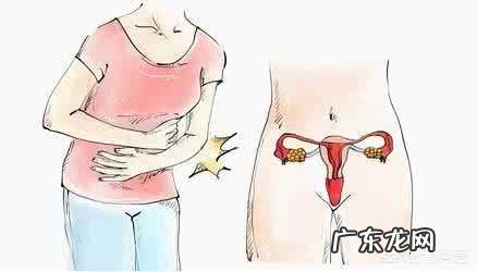 子宫肌瘤严重吗？