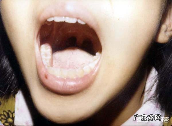 小孩咳嗽该吃什么药呀?